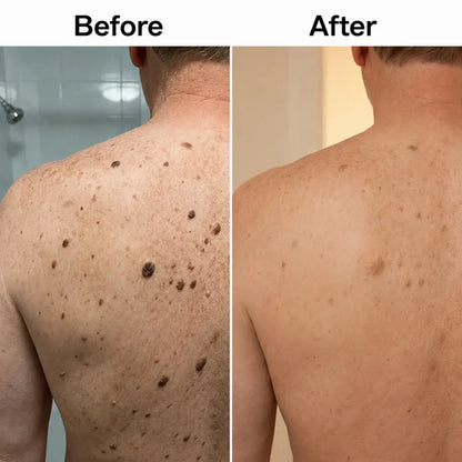Glycolic Body Stick